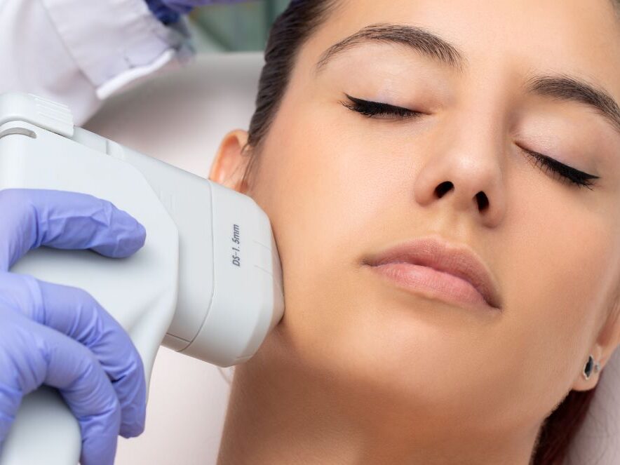 Ultherapy Hifu